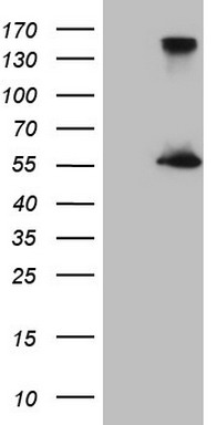IFNG Antibody