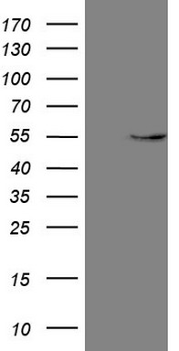 IFNG Antibody