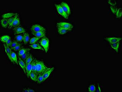 Interferon-induced protein with tetratricopeptide repeats 3 antibody