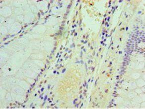 IFIT3 Antibody