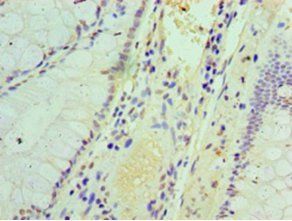 Interferon-induced protein with tetratricopeptide repeats 3 antibody