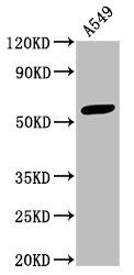 Interferon-induced protein with tetratricopeptide repeats 3 antibody