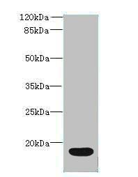 Interleukin-36 R antagonist antibody