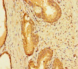 INTS9 Antibody
