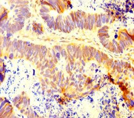 INTS9 Antibody