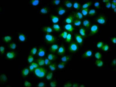 INTU Antibody