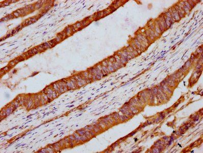 INTU Antibody