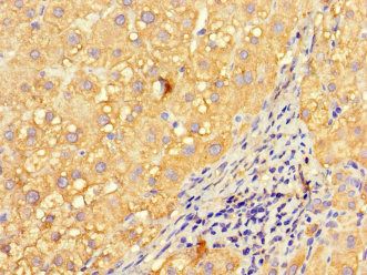 INVS Antibody