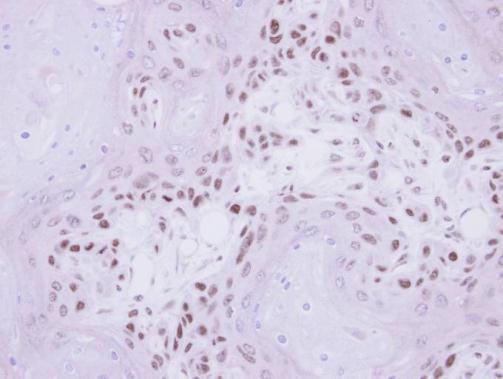 IP6K1 antibody