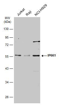 inositol hexakisphosphate kinase 1 Antibody