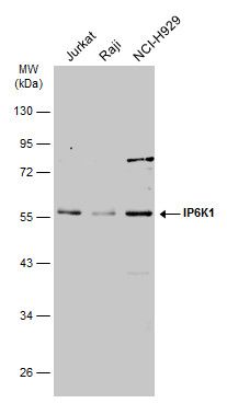 IP6K1 antibody
