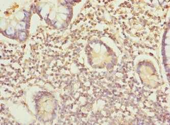 IP6K2 Antibody