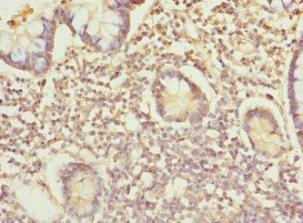 IP6K2 antibody