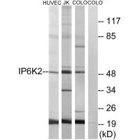 IP6K2 antibody