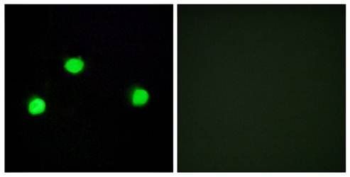 IP6K2 Antibody