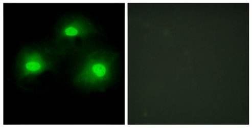 IPKA Antibody