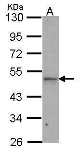 IPMK antibody [N1C2]