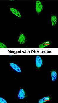 IPMK antibody