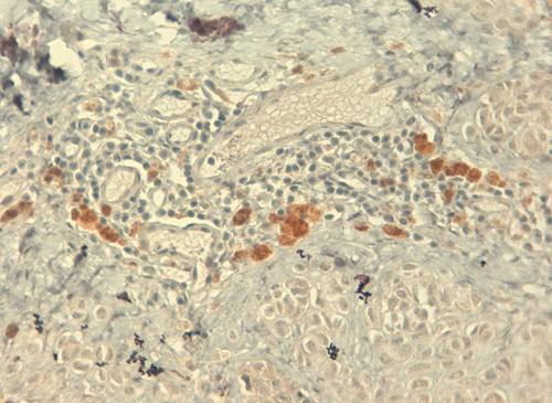 Insulin-Like Growth Factor Monoclonal Antibody