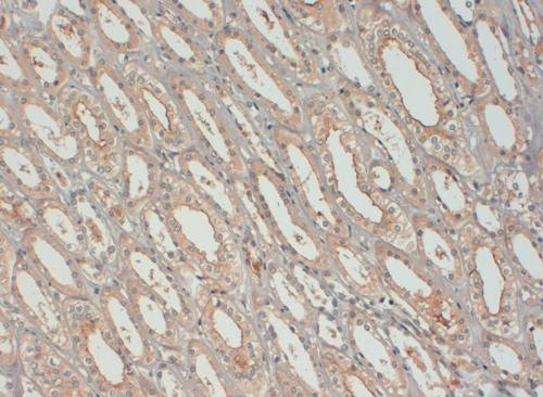 Insulin-Like Growth Factor Monoclonal Antibody