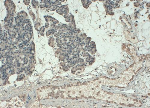 Parathyroid Hormone Monoclonal Antibody