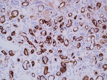 C4d Complement fragment Monoclonal Antibody