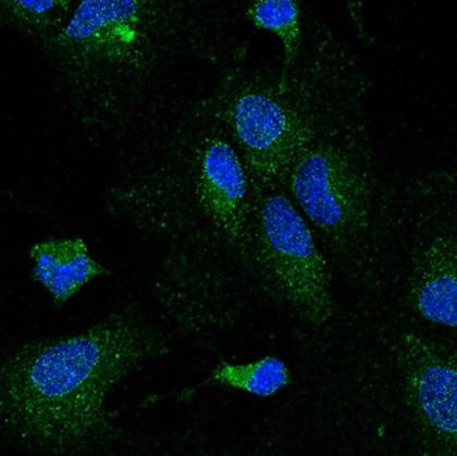 Lipoprotein Lipase Monoclonal Antibody