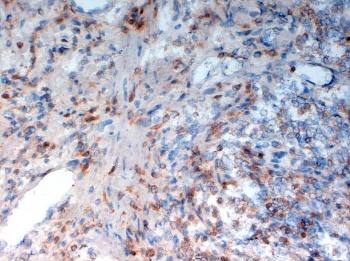 CD33 Monoclonal Antibody