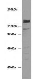 Desmoglein 2/DSG2 Monoclonal Antibody