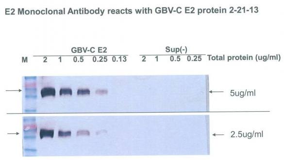 GBV-C virus glycoprotein E2 antibody