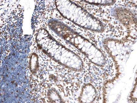 Lamin A+C Monoclonal Antibody