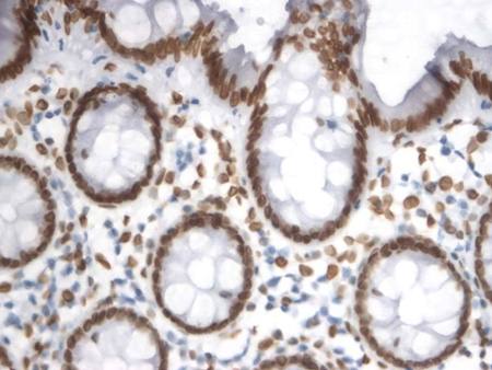 Lamin A+C Antibody (HRP)