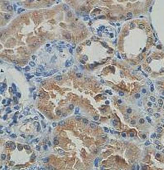 IQCA1 Rabbit Polyclonal Antibody