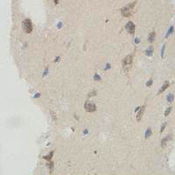 IQCC Rabbit Polyclonal Antibody