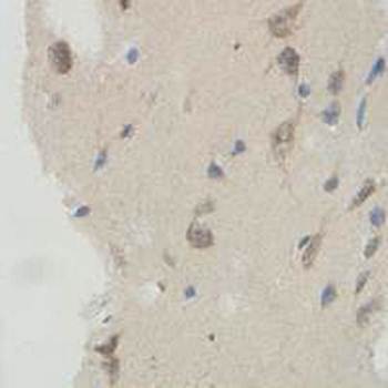 IQCC antibody