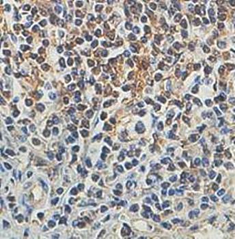 IQCE Rabbit Polyclonal Antibody