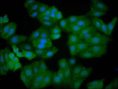 IQGAP2 Antibody