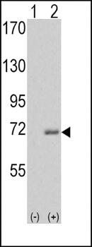 IRAK antibody
