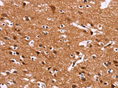 IRAK1BP1 Antibody