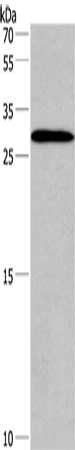 IRAK1BP1 Antibody