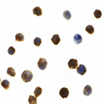 IRAK2 Antibody