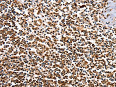 IRAK3 Antibody