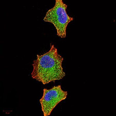 IRAK3 Antibody