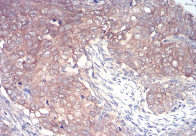 IRAK3 Antibody