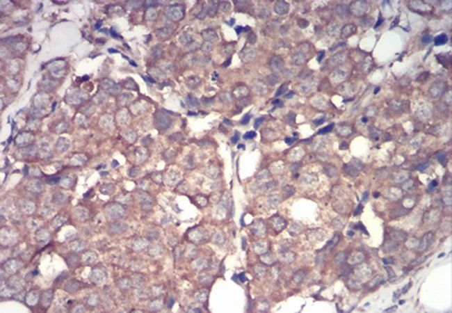 IRAK3 Antibody