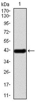 IRAK3 Antibody