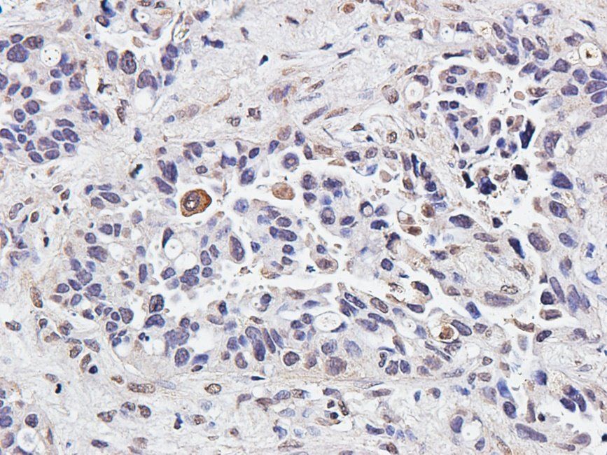 IRAK4 antibody