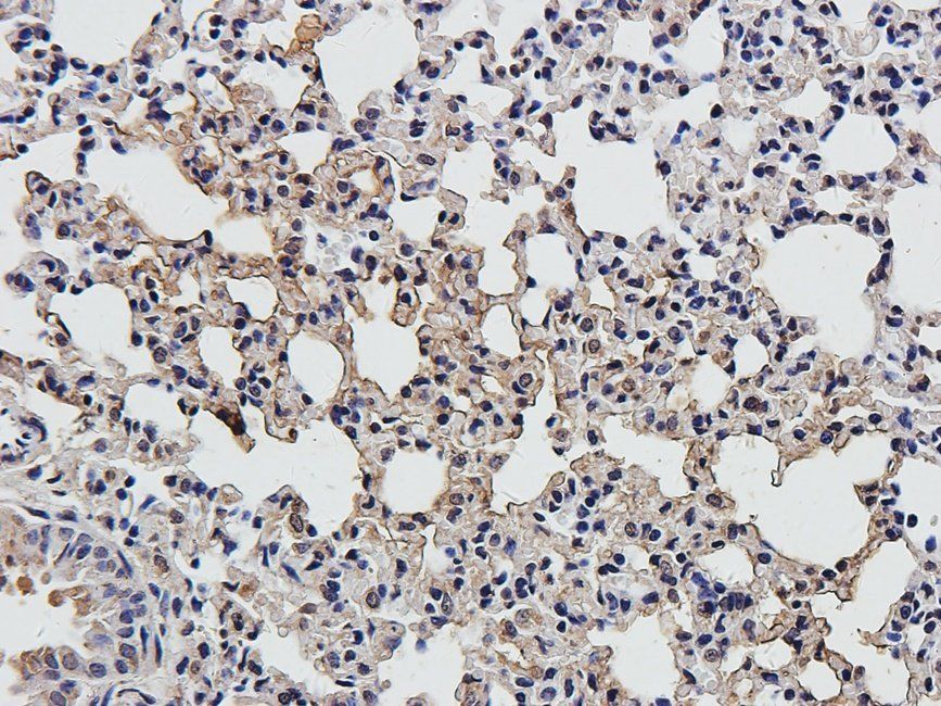 IRAK4 antibody