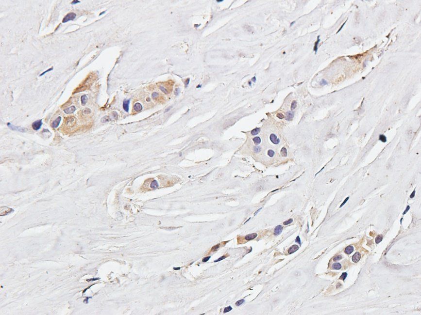 IRAK4 antibody