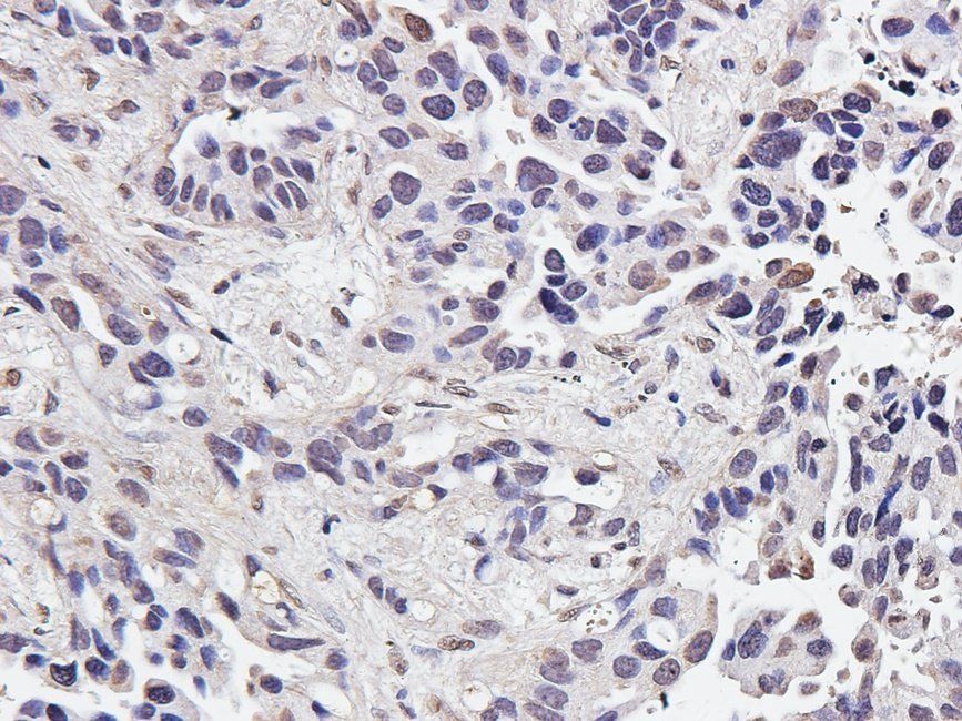 IRAK4 antibody